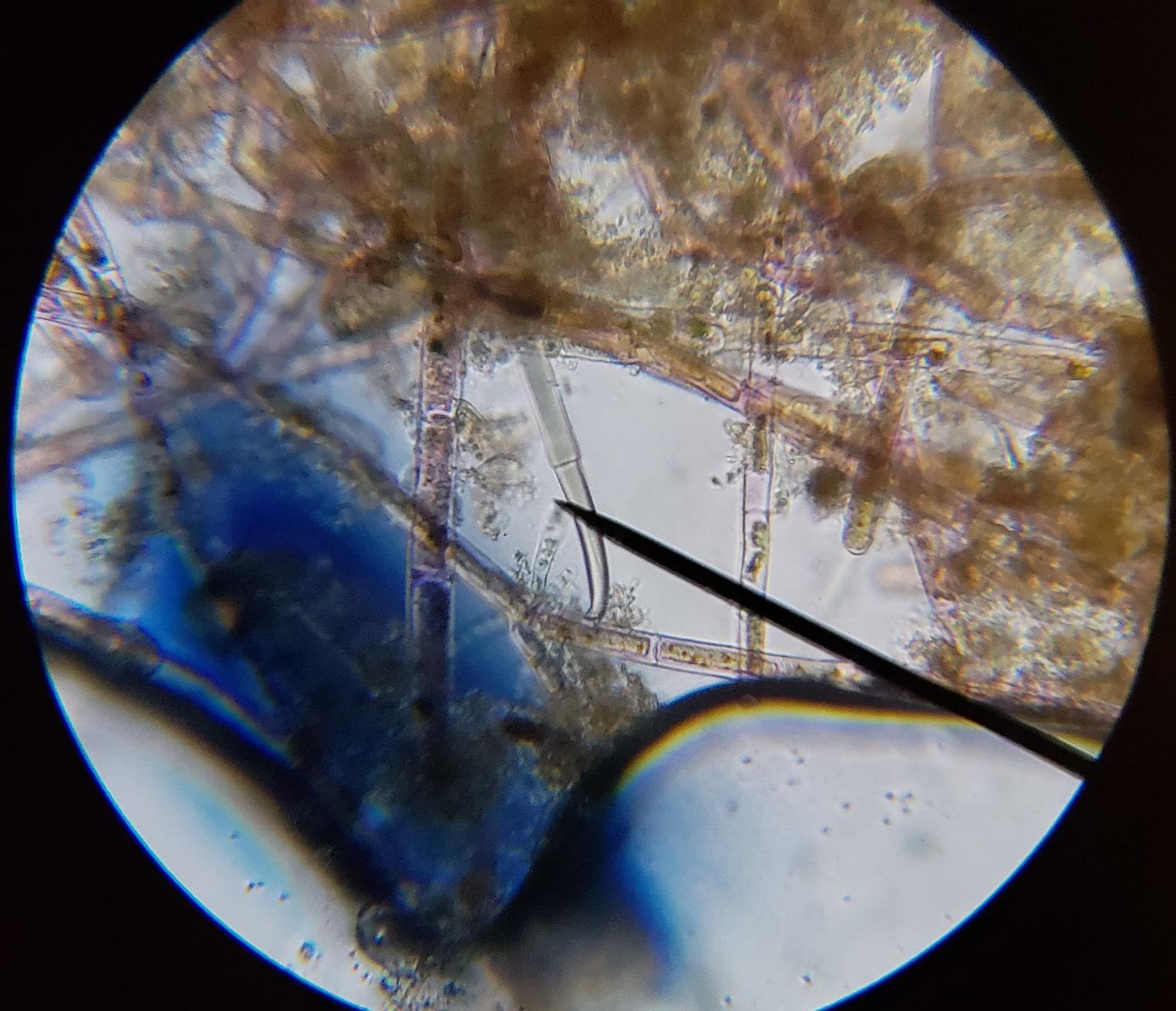 AmScope M150C 1000X All-Metal Optical Glass Lenses Cordless LED Compound Biological Microscope, 40X-1000X Magnification customer photo 1