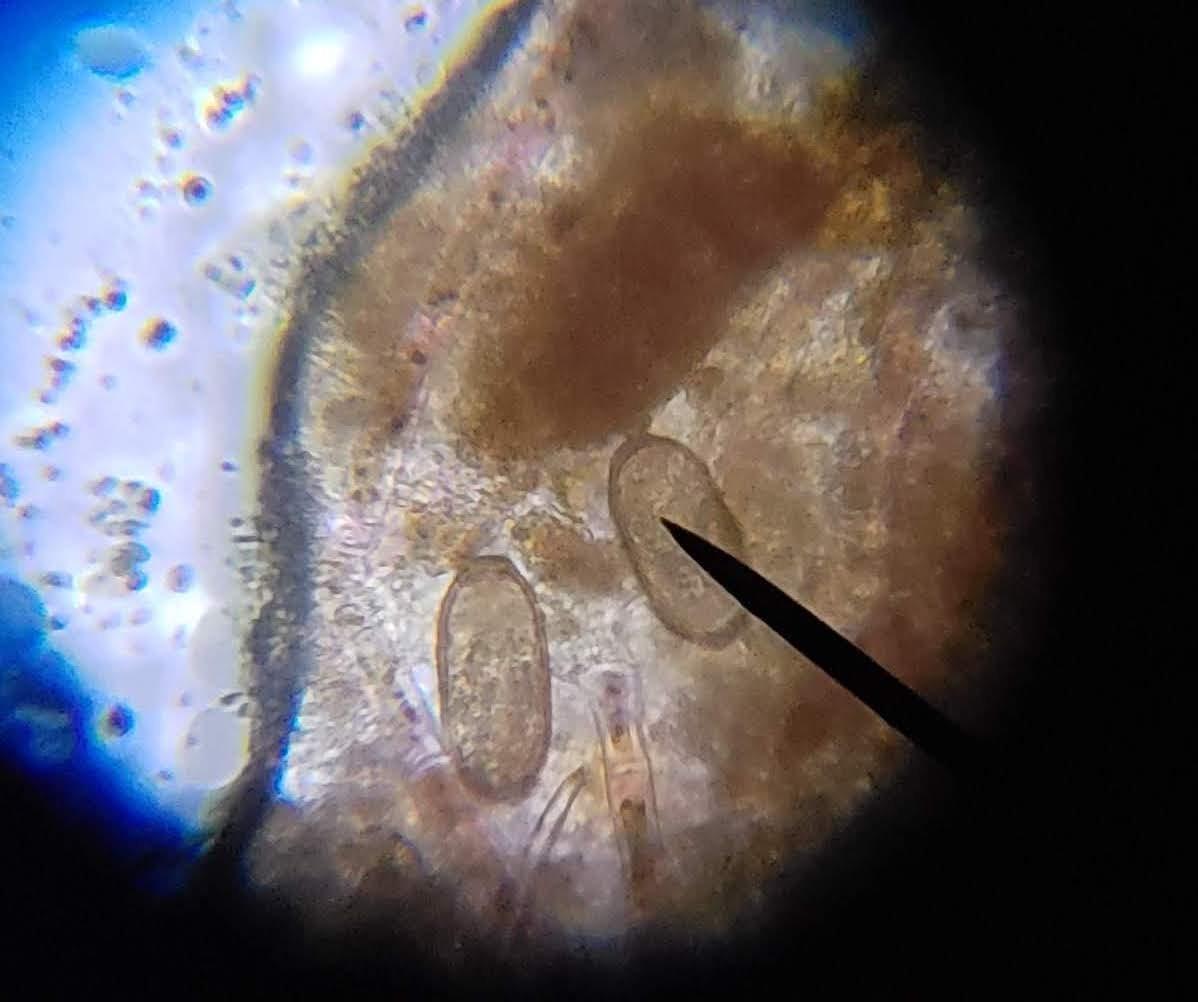 AmScope M150C 1000X All-Metal Optical Glass Lenses Cordless LED Compound Biological Microscope, 40X-1000X Magnification customer photo 2