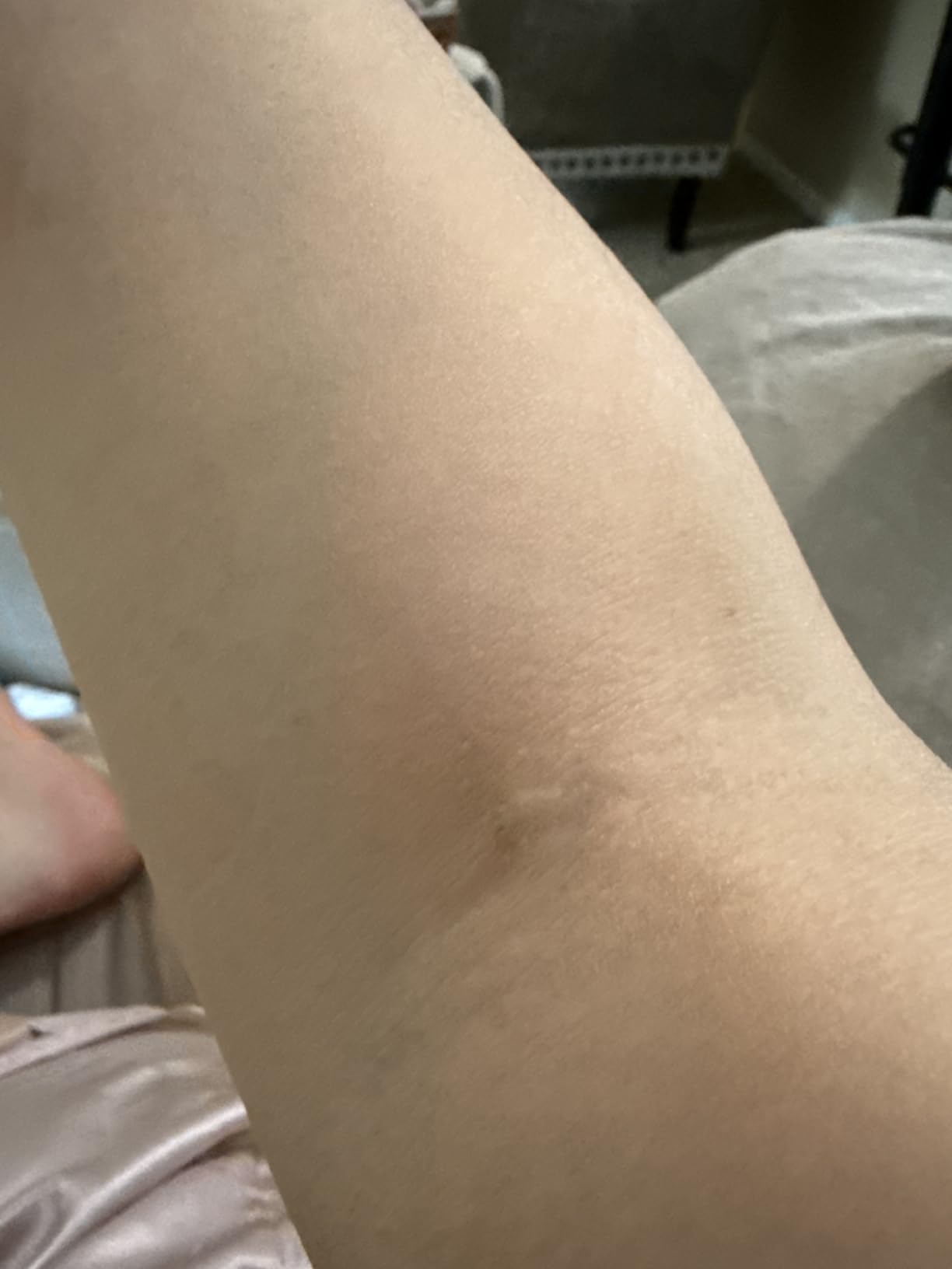 Solawave 4-in-1 Red Light Therapy Wand for Face & Neck (Rose Gold) - FDA-cleared customer photo 1