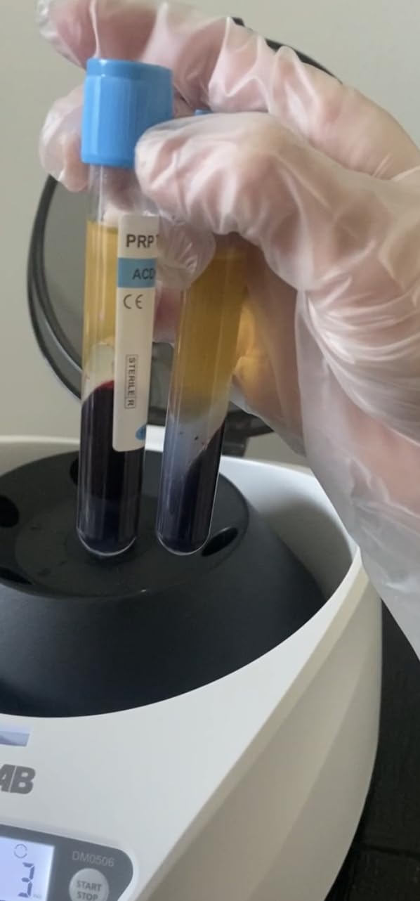 ONiLAB Lab PRP Centrifuge, 6X15ml/10ml/7ml/1.5-5ml, 300-5000RPM, Max 2600×g customer photo 2