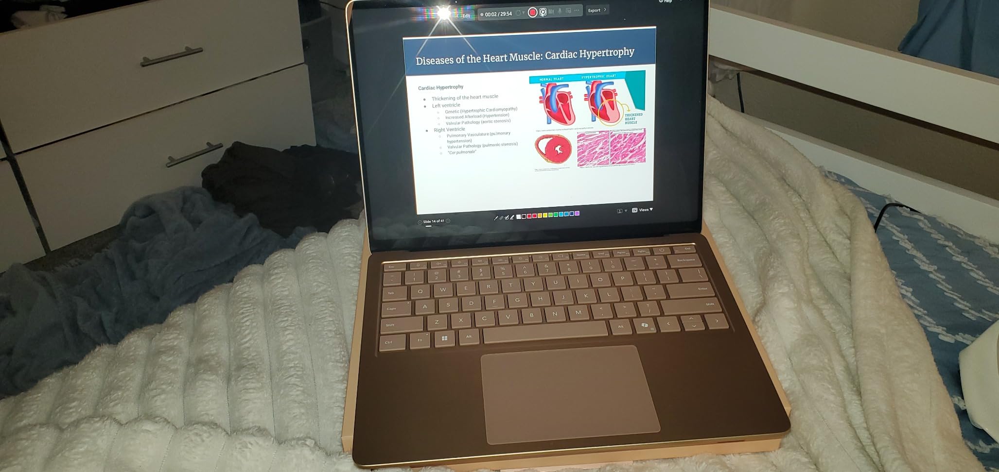 Microsoft Surface Laptop (2024), Windows 11 Copilot+ PC, 13.8