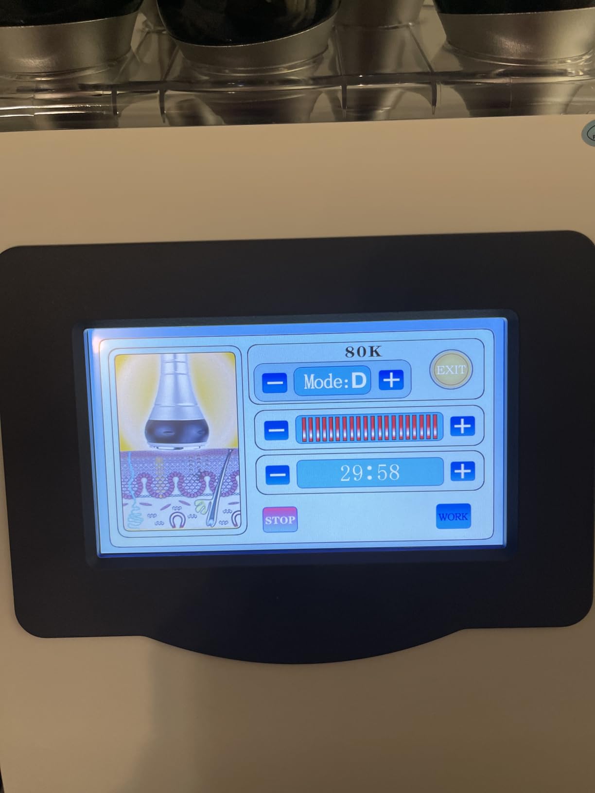 Body Massager Multifunction Beauty for Improvement in The Appearance of Cellulite Device customer photo 2