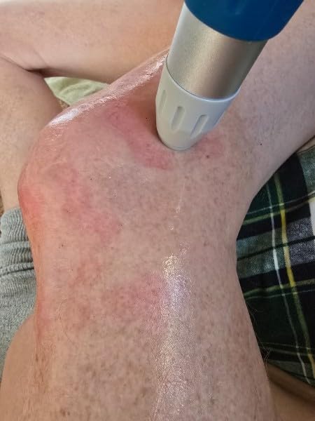 Professional Shockwave Therapy Machine ESWT T800 for Joint, Muscle, Back, Shoulder, Golfer's Elbow, Rotator Cuff Pain customer photo 2