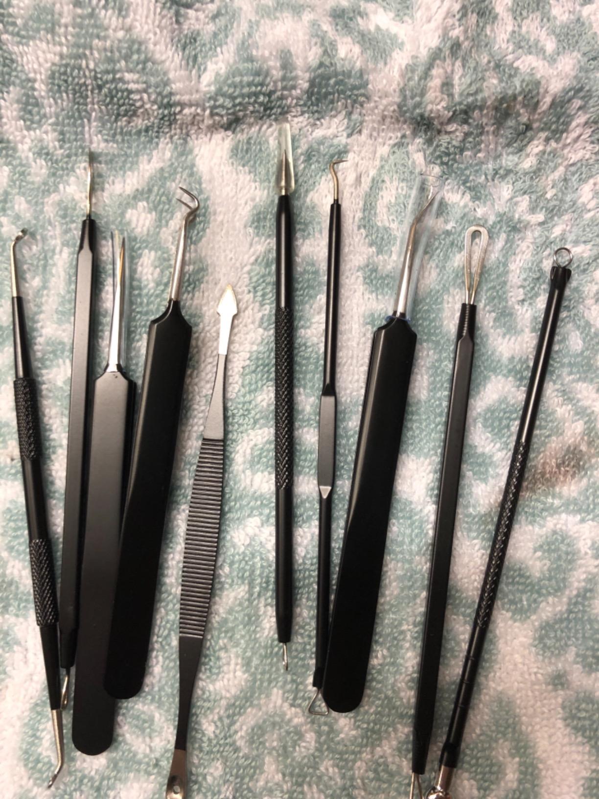 Blackhead Remover Pore Vacuum Kit -Blackhead Extractor Tool | with 3 Adjustable Suction Levels, 5 Probes, USB Rechargeable, Suitable for Women and Men(golden) customer photo 1